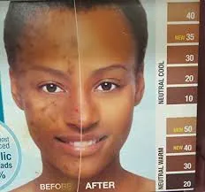 Cover   Care Acne Cover & Control Cream Foundation by Kiss